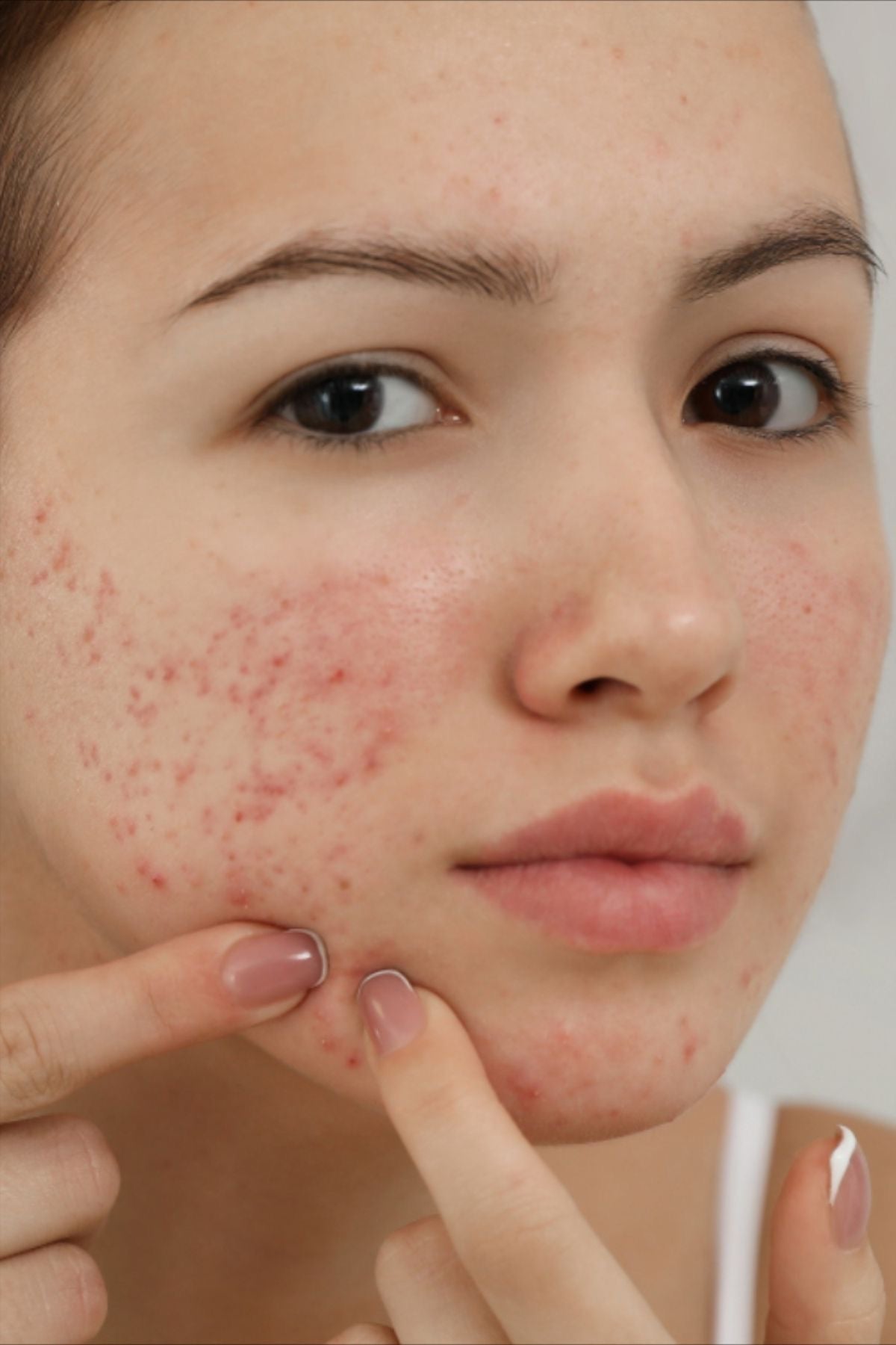 Dark spots routine